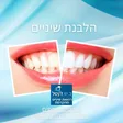 ב.ש דנטל - גשר לשיניים בבאר שבע