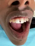 רופא שיניים חרום