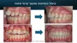 ד"ר האדי אסלאן, מומחה ליישור שיניים